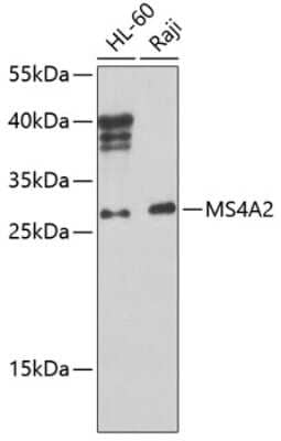 Western Blot: Fc epsilon RI beta/MS4A2 AntibodyBSA Free [NBP3-02954]